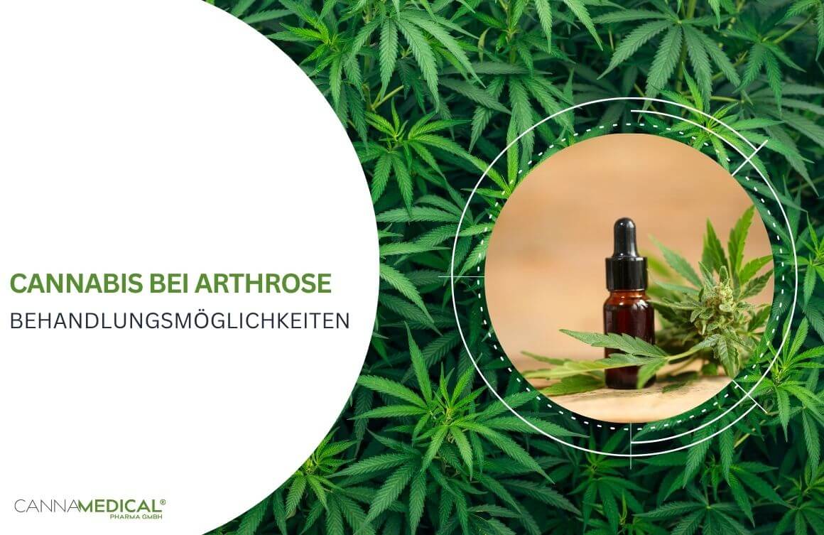 cannabis bei arthrose behandlung