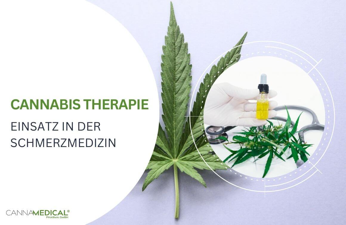 cannabis therapie schmerzmedizin